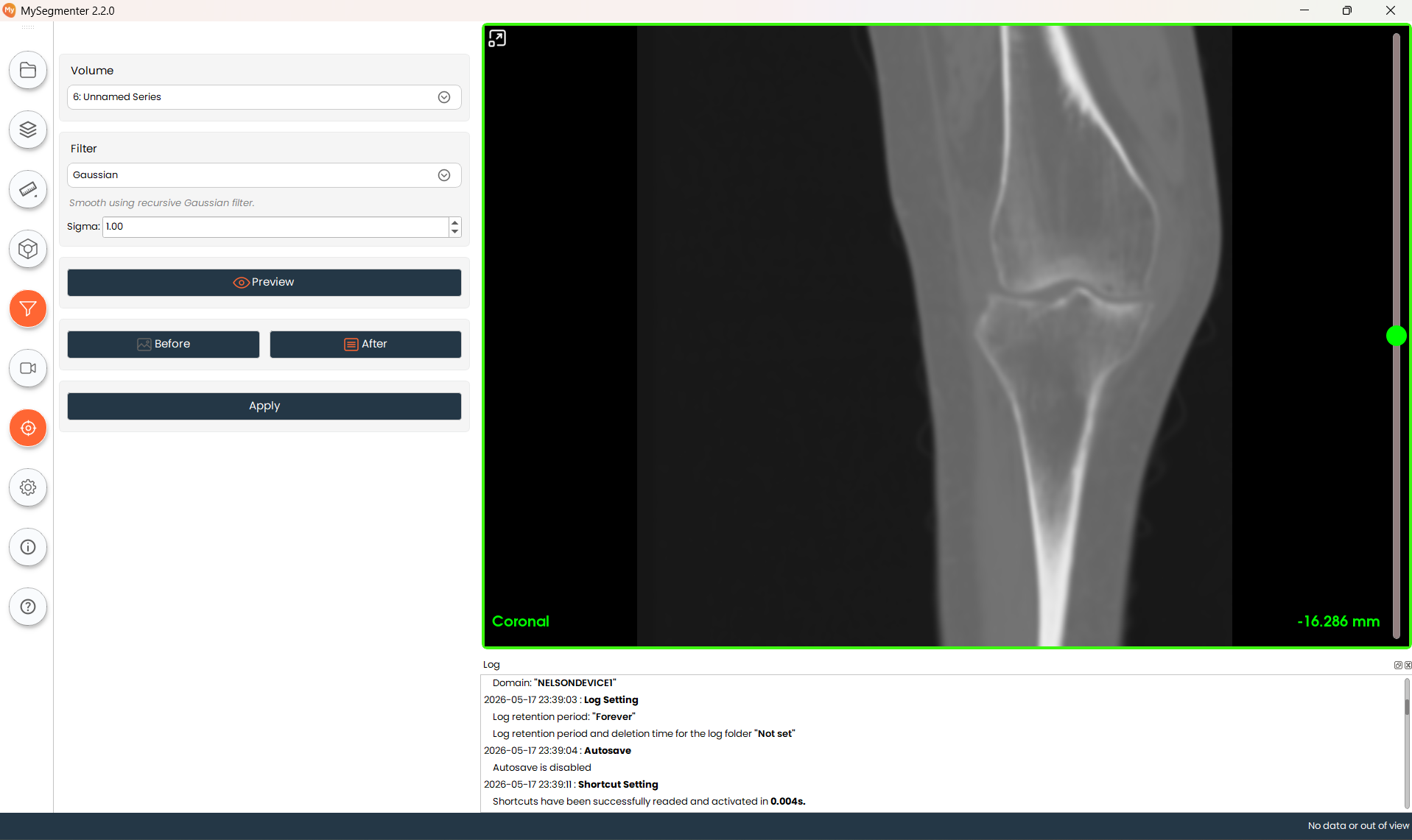 DICOM Image Filter