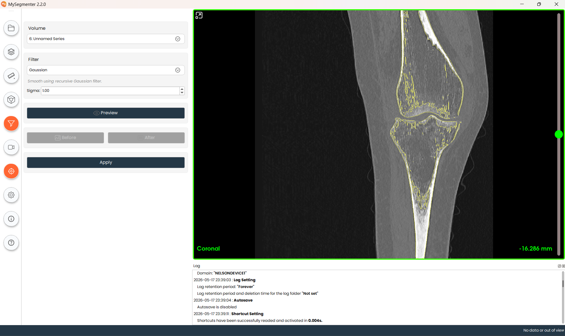 DICOM Image Filter